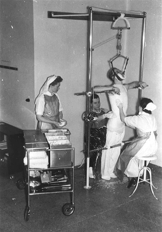 Black and white picture of a man in a plaster cradle and hospital staff.