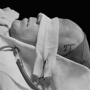 Lennart Nilsson,  © Lennart Nilsson Photography, Ansiktet på en liggande man med bandage över ögonen och ett sår i tinningen. 